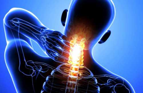 шейный остеохондроз: симптомы и лечение дома