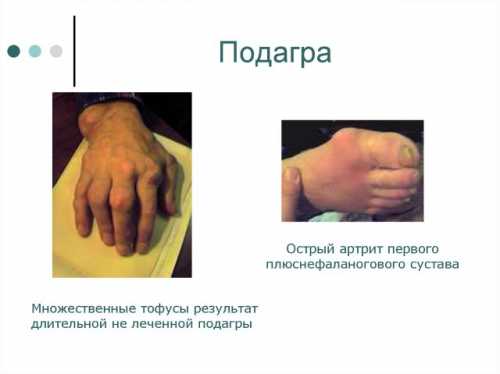 причины потемнения половых губ: беременность, возрастные изменения, болезни причины потемнения половых губ: беременность, возрастные изменения, болезни