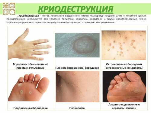 нужен ли загранпаспорт для поездки в черногорию россиянам в 2019 году